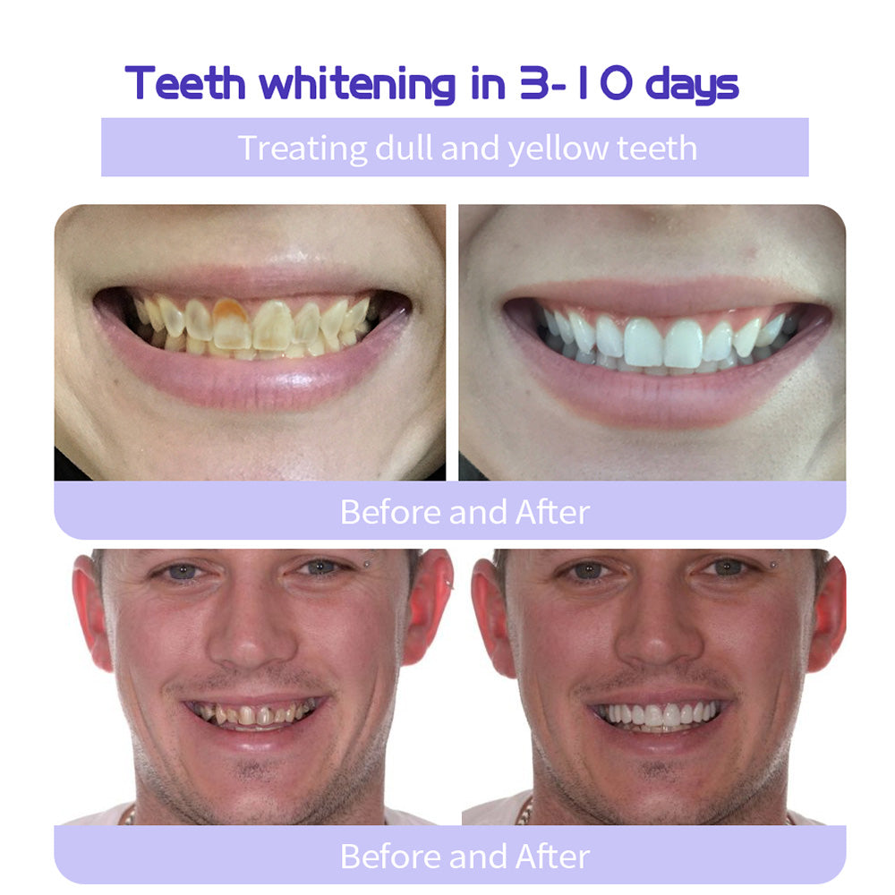 🔥ODALIT™ TeethRestoration Mineral Powder🦷Obtain American Dental Association (ADA) Certification (Treats periodontitis and mouth ulcers, prevents tooth loss, and repairs gum recession)
