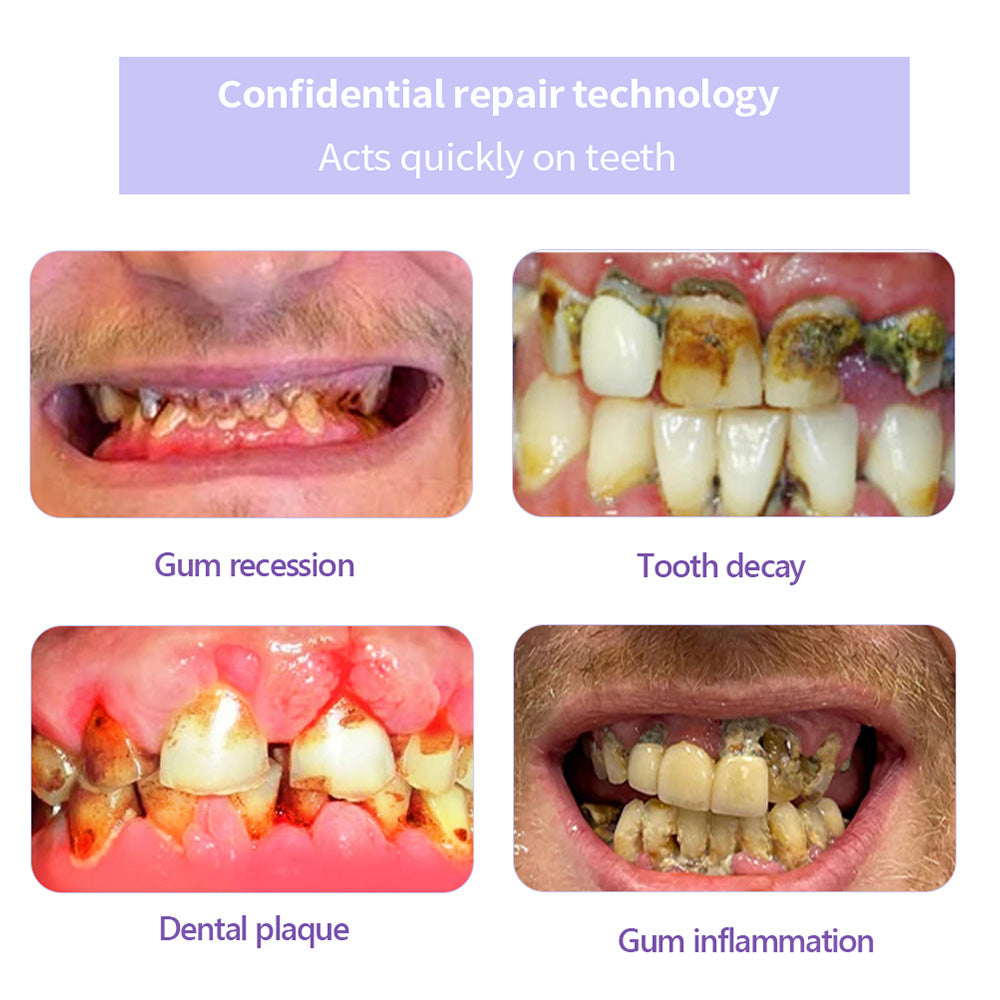🔥ODALIT™ TeethRestoration Mineral Powder🦷Obtain American Dental Association (ADA) Certification (Treats periodontitis and mouth ulcers, prevents tooth loss, and repairs gum recession)