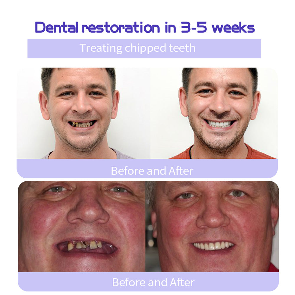 🔥ODALIT™ TeethRestoration Mineral Powder🦷Obtain American Dental Association (ADA) Certification (Treats periodontitis and mouth ulcers, prevents tooth loss, and repairs gum recession)