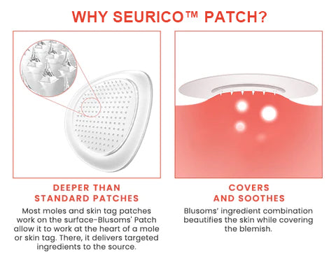 Seurico™ Pro MicroDarts TAG'Gone Patch