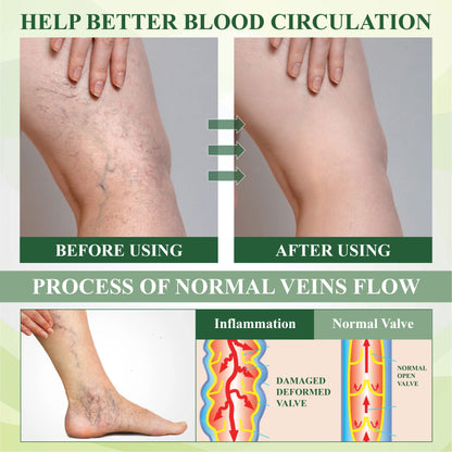 🏆ODEIUN™ CircuHerb Edema Soothing & Healing Balm | Instant Swelling Soothing • Vascular Care • Herbal Recovery ✨